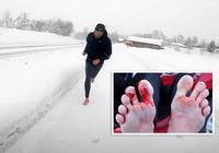 Chân tóe máu vì cố phá kỷ lục thế giới chạy 21km chân trần trên tuyết