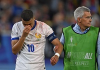 Mbappe phản ứng hài hước khi bị gãy mũi