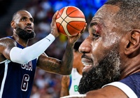 LeBron James rách mí mắt, khâu 4 mũi trước thềm 2 trận cuối cùng tuyển Mỹ tại Olympic 2024