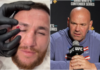 Dana White nổi điên với Merab Dvalishvili vì "khoe chấn thương, tự cắt chỉ"