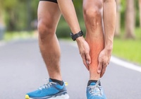 Đau ống đồng khi chạy: Nguyên nhân và cách xử lý