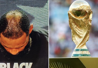 Vết hói đầu của LeBron James bị troll không thương tiếc