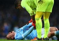 Kevin De Bruyne nghỉ dài hạn: Phép thử cho Man Xanh