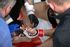Chấn thương kinh hoàng: Võ sĩ MMA... rơi ngón tay giữa trận đấu