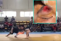 Tai nạn húc đầu tại giải Jujitsu toàn quốc, võ sĩ phải khâu 30 mũi