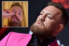 Vụ Conor McGregor bị tố tấn công DJ người Ý: Đối phương bị đánh gãy mũi, đã gửi đơn kiện