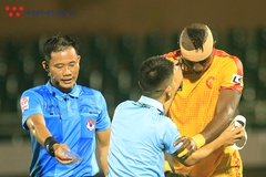 Một trọng tài V.League nhập viện cấp cứu khi kiểm tra thể lực
