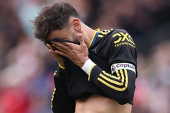 Dự đoán MU vs Sunderland, 21h00 ngày 4/10, Ngoại hạng Anh 2025/26