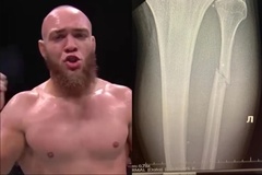 "Lấy chân đổi chân": Võ sĩ UFC lập kỷ lục 4 đòn "xoắn gót" liên tiếp 