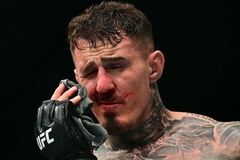 Tom Aspinall chỉ trích chủ tịch Dana White sau vụ chọc mắt ở UFC 321