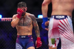 Chấn thương khủng khiếp của Ilia Topuria sau trận chiến tại UFC Nhà Trắng