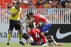 Derby Madrid: Tiền đạo của Real bị... cắn và phạm lỗi 20 lần 