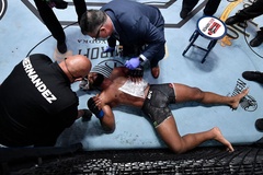 Kinh hoàng Ảnh chụp chiếc sườn gãy của cựu vương UFC Tyron Woodley