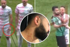 SỐC: Cầu thủ Thổ Nhĩ Kỳ giấu hung khí tấn công đối phương