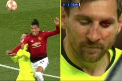 Tin bóng đá 13/4: HLV Valverde hé lộ tình hình Messi sau va chạm kinh hoàng