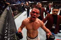 Nate Diaz muốn thi đấu Boxing nhưng bị "kẹt" ở UFC