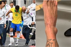 Neymar tung ảnh mắt cá chân sưng to... "kinh dị" sau khi bị loại khỏi Copa America 2019