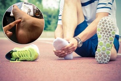 Bệnh viêm cân gan chân khi chạy: Nỗi lo và cách khắc phục