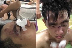 Thắng đậm đối thủ bắt qua mạng, đội bóng sinh viên bị đánh đến nhập viện
