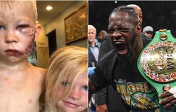 WBC ra mắt hạng cân mới Bridgerweight, lấy cảm hứng từ cậu bé 6 tuổi cứu em gái khỏi chó dữ