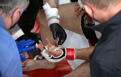 Chấn thương kinh hoàng: Võ sĩ MMA... rơi ngón tay giữa trận đấu