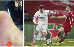 Sao Real Madrid đá cả trận gặp Liverpool với đôi chân bầm tím