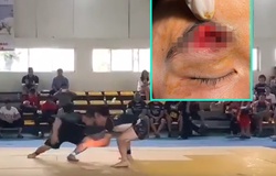 Tai nạn húc đầu tại giải Jujitsu toàn quốc, võ sĩ phải khâu 30 mũi