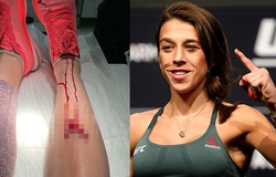 Joanna Jedzejczyk khoe vết thương khi tập luyện: Bạn còn muốn làm võ sĩ?