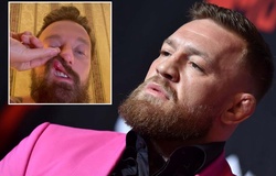 Vụ Conor McGregor bị tố tấn công DJ người Ý: Đối phương bị đánh gãy mũi, đã gửi đơn kiện