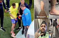 Brazil áp dụng công nghệ NASA để chữa trị chấn thương cho Neymar