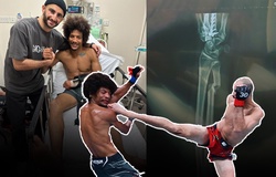 Võ sĩ UFC Alex Caceres gãy tay vì đỡ đòn đá của đối thủ ngay hiệp 1