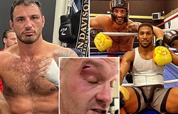 Trận Tyson Fury - Usyk bị hoãn nhưng "thủ phạm đấm rách mắt" vẫn không xin lỗi