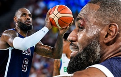 LeBron James rách mí mắt, khâu 4 mũi trước thềm 2 trận cuối cùng tuyển Mỹ tại Olympic 2024