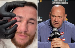 Dana White nổi điên với Merab Dvalishvili vì "khoe chấn thương, tự cắt chỉ"