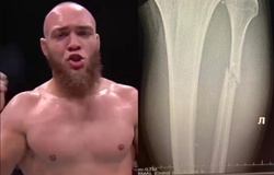 "Lấy chân đổi chân": Võ sĩ UFC lập kỷ lục 4 đòn "xoắn gót" liên tiếp 