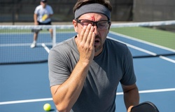 Thống kê đáng chú ý về chấn thương trong pickleball