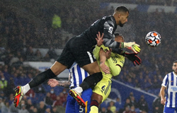 Hậu vệ Arsenal lần thứ hai mất răng trước cùng đối thủ Brighton