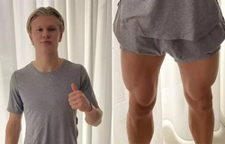 Erling Haaland gây sốt khi khoe bắp đùi bất thường