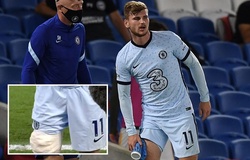 Timo Werner phải băng đầu gối khi Chelsea chuẩn bị gặp Liverpool
