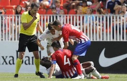 Derby Madrid: Tiền đạo của Real bị... cắn và phạm lỗi 20 lần 