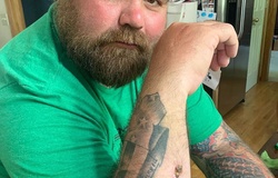 Cựu vô địch UFC kêu cứu vì bị bỏ mặc sau chấn thương