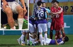 Tin bóng đá Việt Nam ngày 7/3: Ngọc Hải lẽ ra phải nhận thẻ đỏ, HLV Park có thêm viện binh