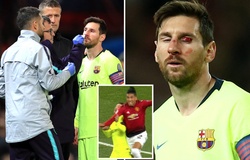 Tiết lộ sốc: Messi không thể thở bình thường sau pha va chạm kinh hoàng với Smalling