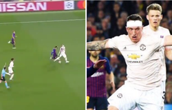 Messi “hành hạ” Phil Jones đến mức bung cả băng quấn đầu thế nào?