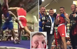 Conor McGregor bị đối thủ nghiệp dư "bóc phốt" chơi bẩn