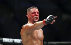 Nate Diaz chọn Anthony Pettis để trận đấu đỡ "chán"