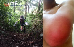 Cách phòng tránh và xử lý côn trùng tấn công khi chạy địa hình