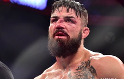 Pha gãy mũi đầy ám ảnh của Mike Perry sau trận đấu với Vicente Luque