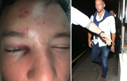 Cựu sao Chelsea bị đánh hội đồng vì ve vãn người yêu đồng nghiệp