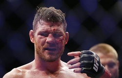Cựu vô địch UFC Michael Bisping tự hào khoe mắt giả ngay giữa show trực tiếp